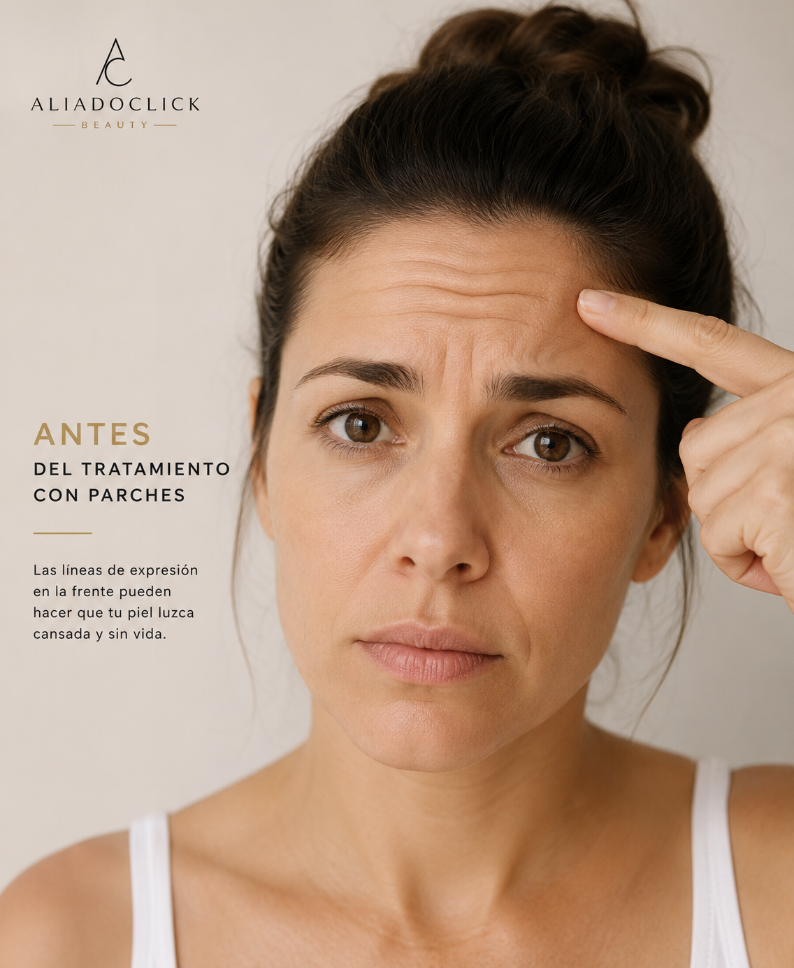 Mujer con l&iacute;neas de expresi&oacute;n en la frente antes del tratamiento con parches AliadoClick Beauty